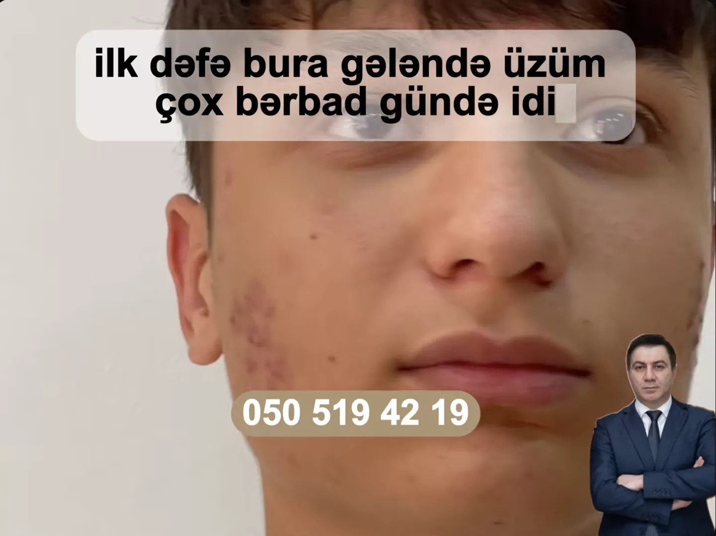 İlk dəfə bura gələndə üzüm çox bərbad gündə idi...